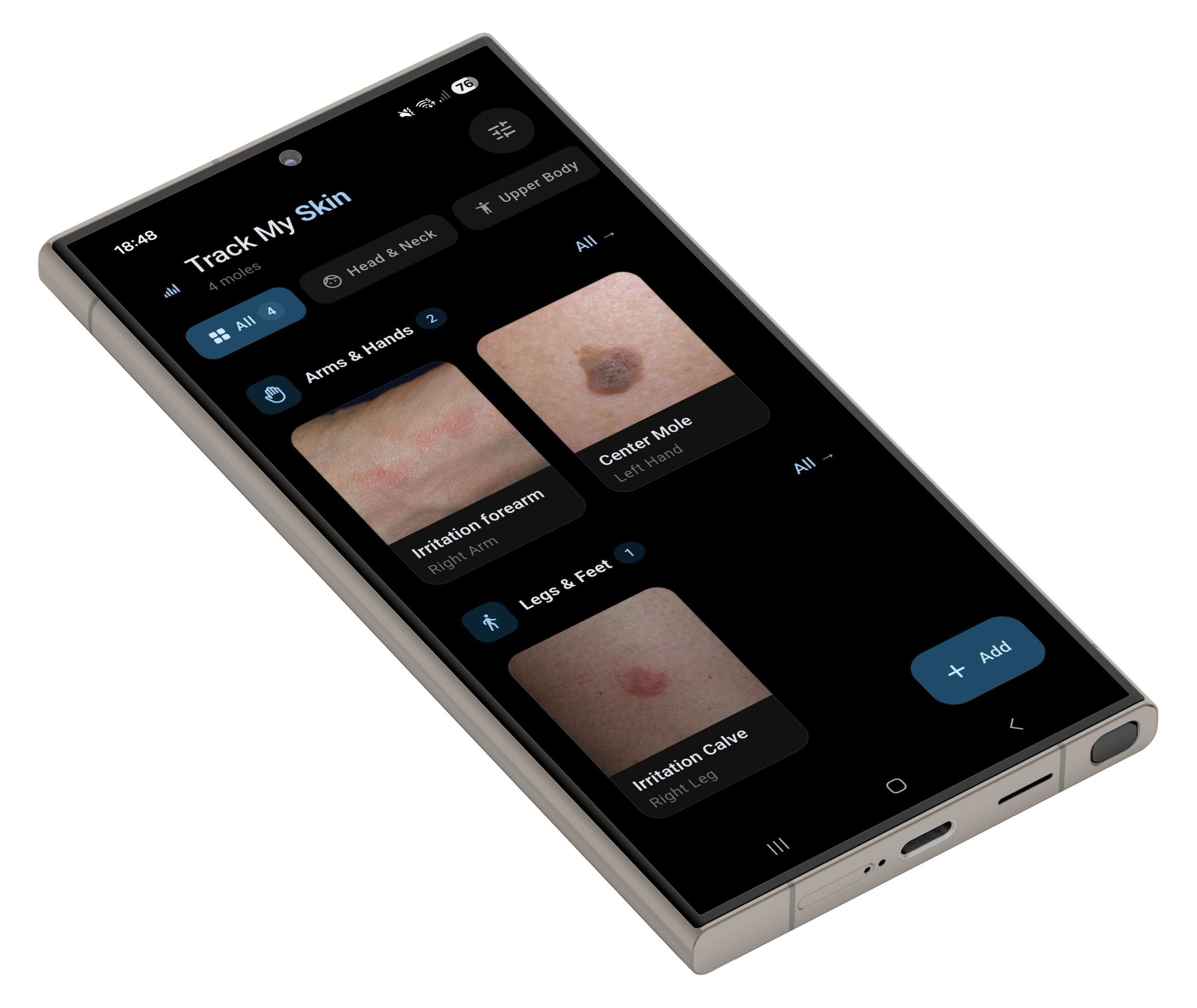 TrackMySkin App auf Samsung Galaxy